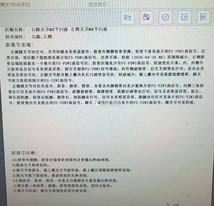 右膝前交叉韌帶損傷 高詩巖赴美康復